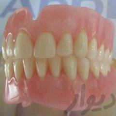 مطب دندانپزشکی , دندانسازی , علی