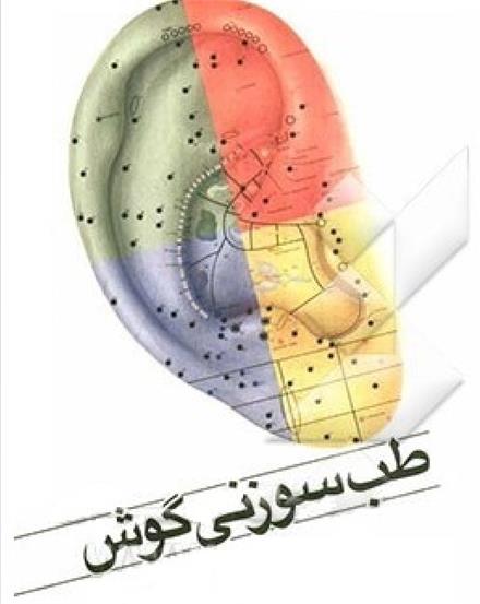 طب سوزنی دکتر واثق _ غرب تهران _ ستارخان _ صادقیه